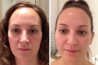 Radiance Reimagined Facial Massager™